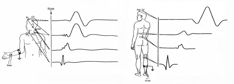 File:SSEP Waveforms.jpg